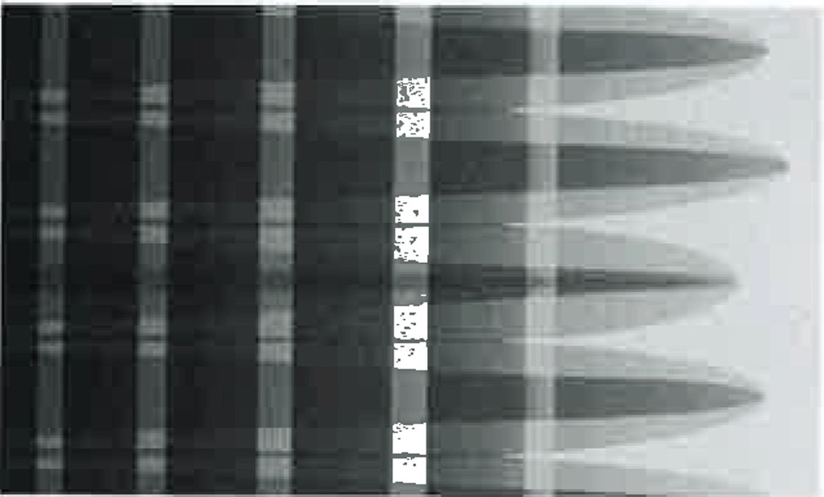 Kurbelmarkise 5200 Wandmontage, 3,5 x 2,5 m, Gehäuse eloxiert, Mystic-Grau